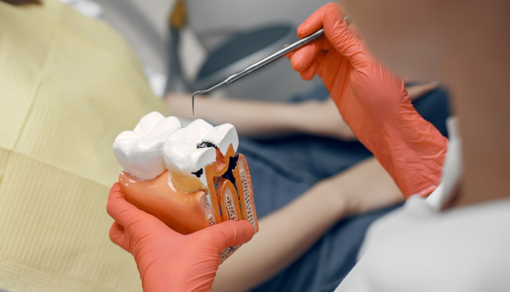 Dental Implant