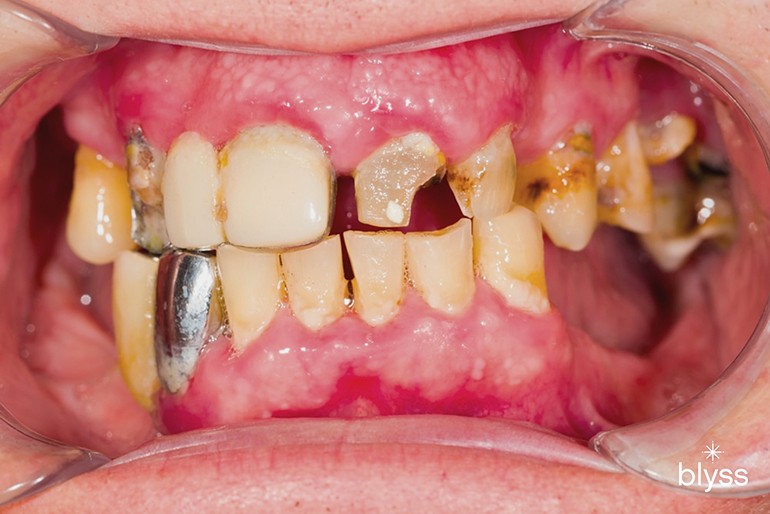 Know the 12 Most Common Dental Problems—and How to Prevent Them