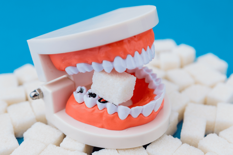 How Sugar Harms Your Teeth: What You Need to Know