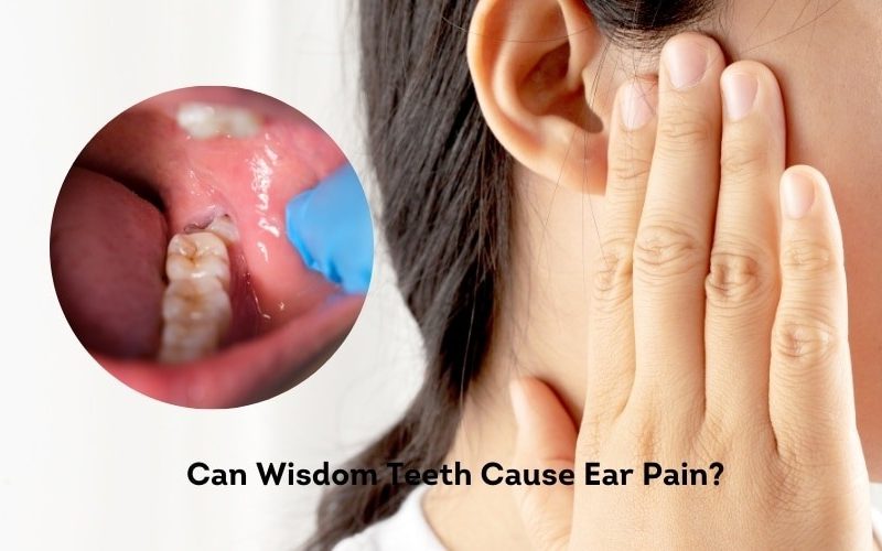Wisdom Teeth: Should You Keep Them or Get Them Removed?