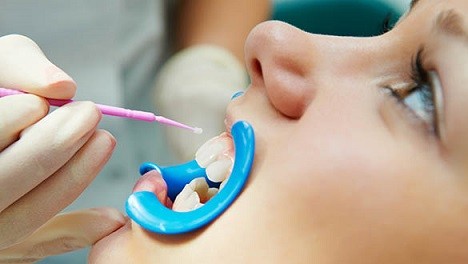 “Importance of Fluoride in Protecting Your Teeth”