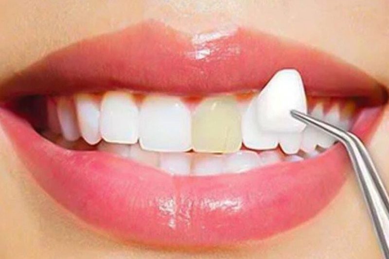 Cosmetic Dentistry Explained: What’s Possible for Your Smile Makeover?